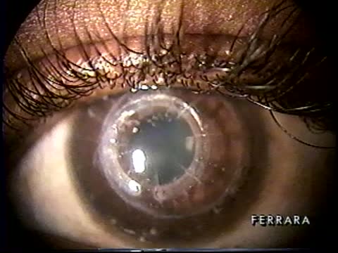 History of Ferrara Ring