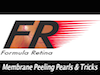Membrane Peeling Pearls and Tricks