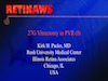 27G Vitrectomy in PVR