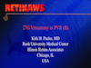 27G Vitrectomy in PVR II