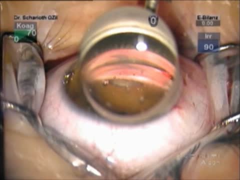 Microscope Mounted Angle Viewing System
