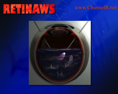 Thumbnail for aspoh