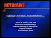 Cataract, Choroidals, Endophthalmitis