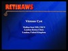Vitreous Cyst