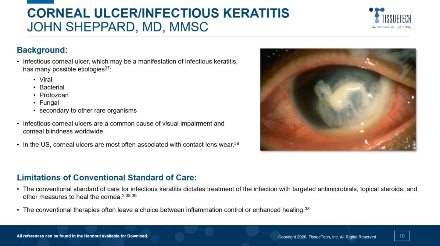 The Use of Cryopreserved Amniotic Membrane for Corneal Ulcers & Infectious Keratitis
