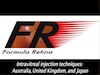 Intravitreal injection techniques: Australia, United Kingdom, and Japan