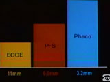 Phaco Sword
