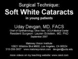 Surgical Technique in Soft White Cataract in Young Eyes