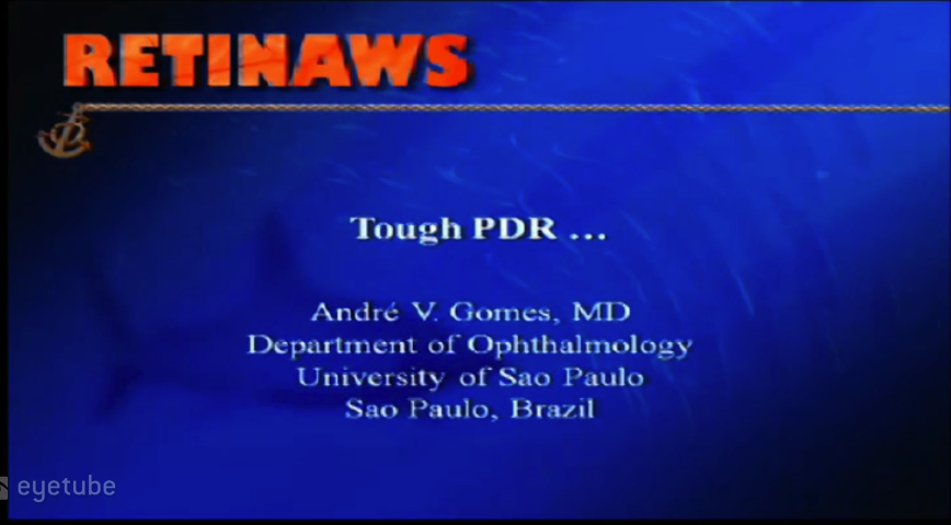 Tough PDR...