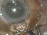 Hermetically Sealed