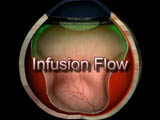 Infusion Flow (French)