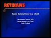 Giant Retina Tear in a Child