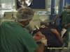 LenSx Femtosecond Laser Cataract