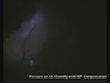 Combined Phaco-Vitrectomy with 25g Valved Cannulae
