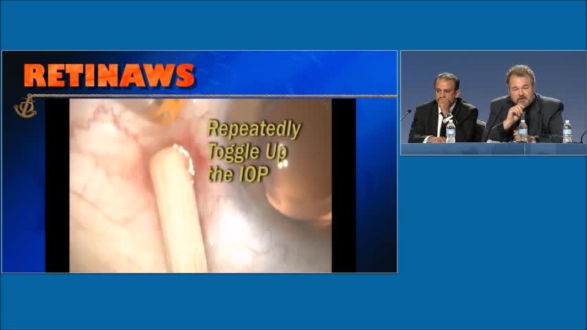 Sclerotomy Closure