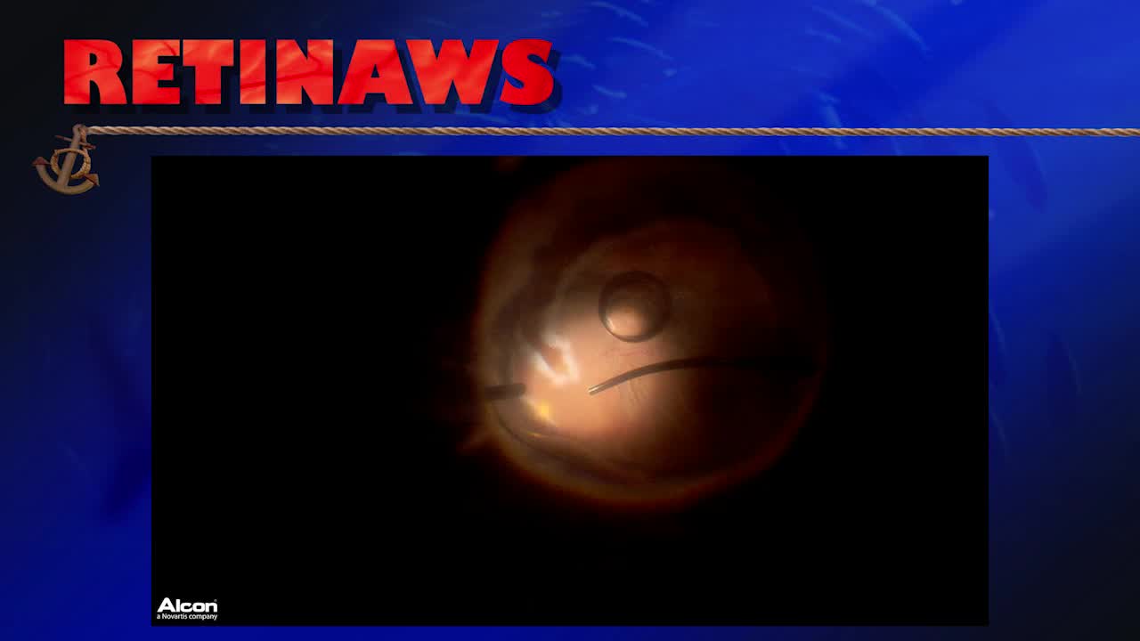 Thumbnail for dlban