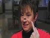 Canaloplasty Patient Testimonials