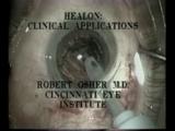 Healon: Clinical Applications
