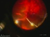Penetrating Injury...