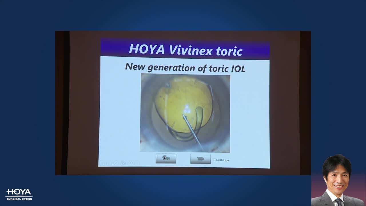Vivinex Toric Can Rule The Market