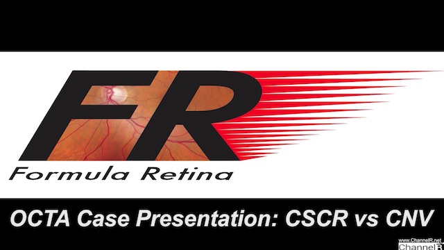 Case Presentation - CSCR vs CNV