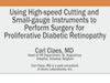 MIVS for Proliferative Diabetic Retinopathy