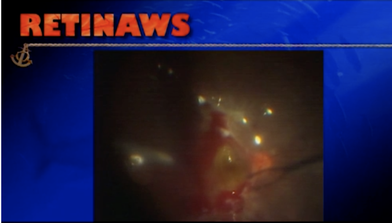 Thumbnail for eemuh