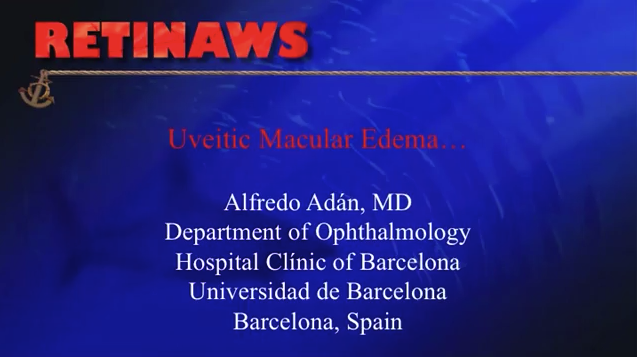 Uveitis Macular Edema