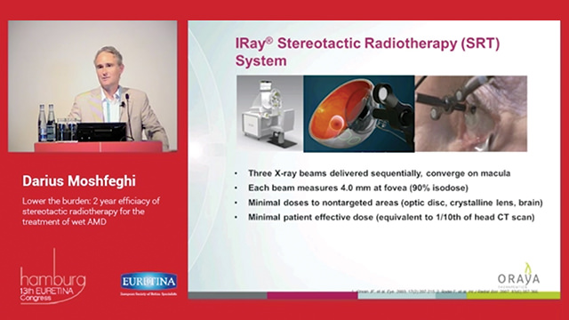 Lower the Burden: Two-Year Efficacy of Stereotactic Radiotherapy for the Treatment of Wet AMD