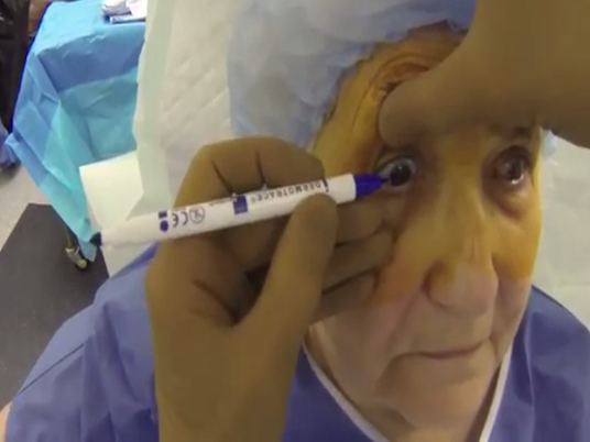 How to Perform Toric Alignment