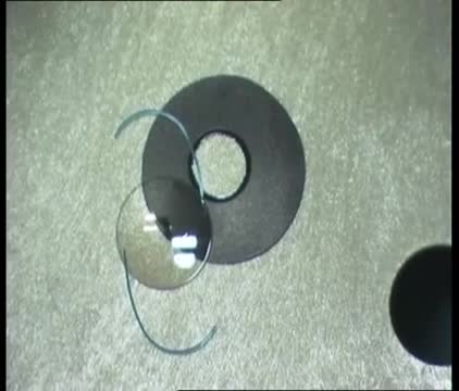 Implantation of a Combined Iris Prosthesis and IOL through a 2.4 mm Incision