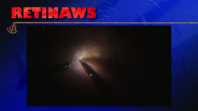 Thumbnail for ehilq