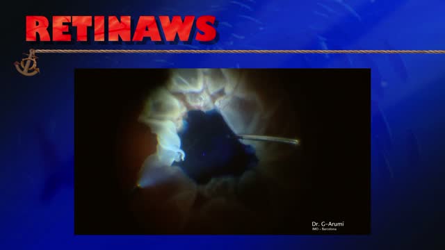 Thumbnail for ejosq