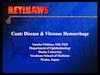 Coats Disease and Vitreous Hemorrhage