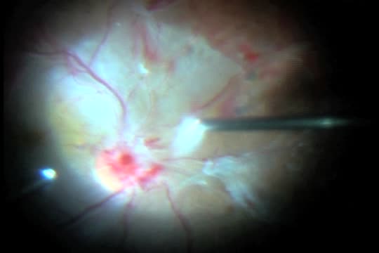 27-Gauge: First Experience