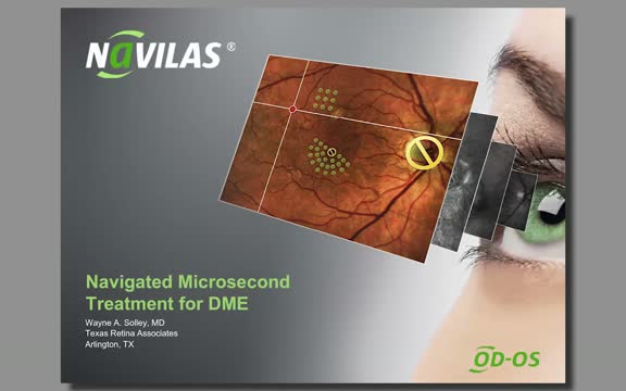 Navigated Microsecond Treatment for DME: Webinar 