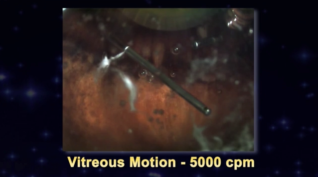 Vitreous Dynamics- The Effect of Cutting Rate