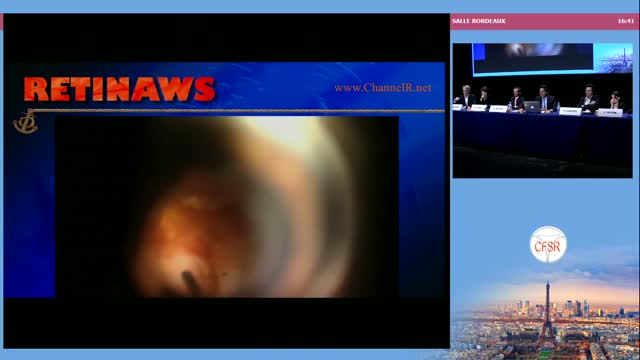 Transparent Choroid 