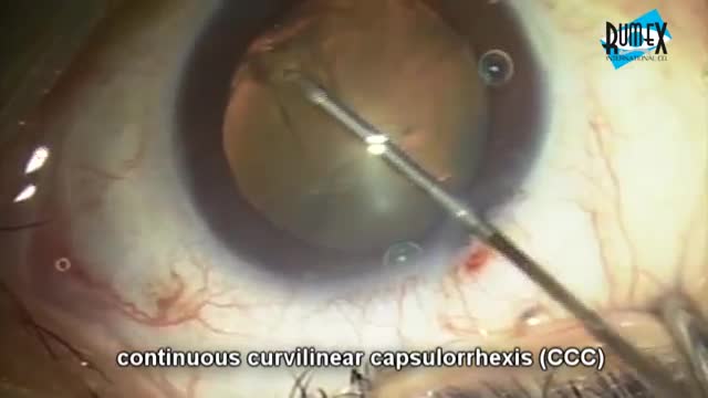 Kawai Capsulorhexis Forceps