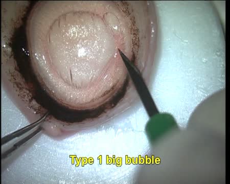 Thumbnail for epoob