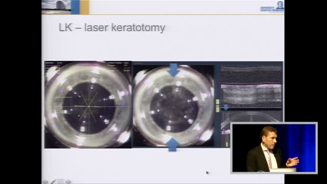 Lens Surgery Diagnostics with the Pentacam