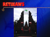Retinaws Bali