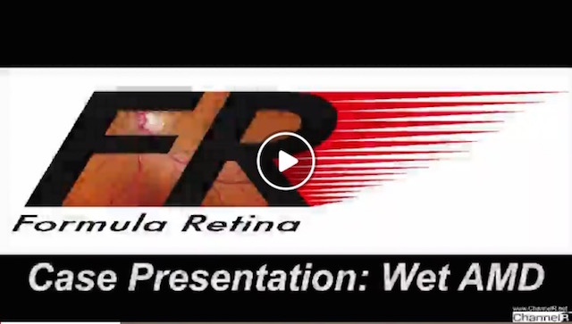 Case Presentation- Wet AMD