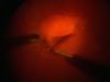 ILM Peeling Under Amber Light
