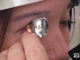 General Gonioscopy Exam Technique