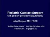 Pediatric Cataract Surgery