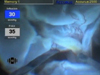 360&ordm; Giant Retinal Tear