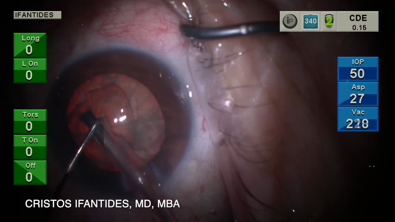 Cortex-Assisted Nuclear Rotation