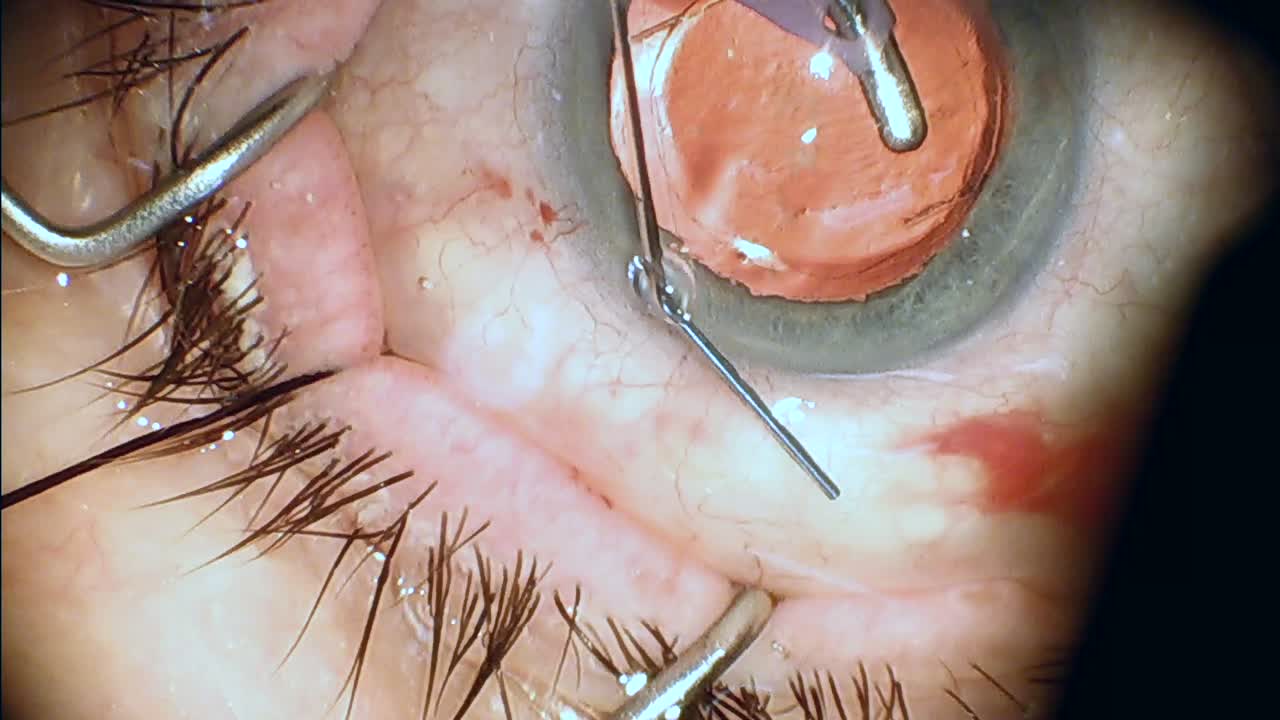 Xen Implantation: Updated Loading System