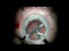 A Preference for Biaxial MICS